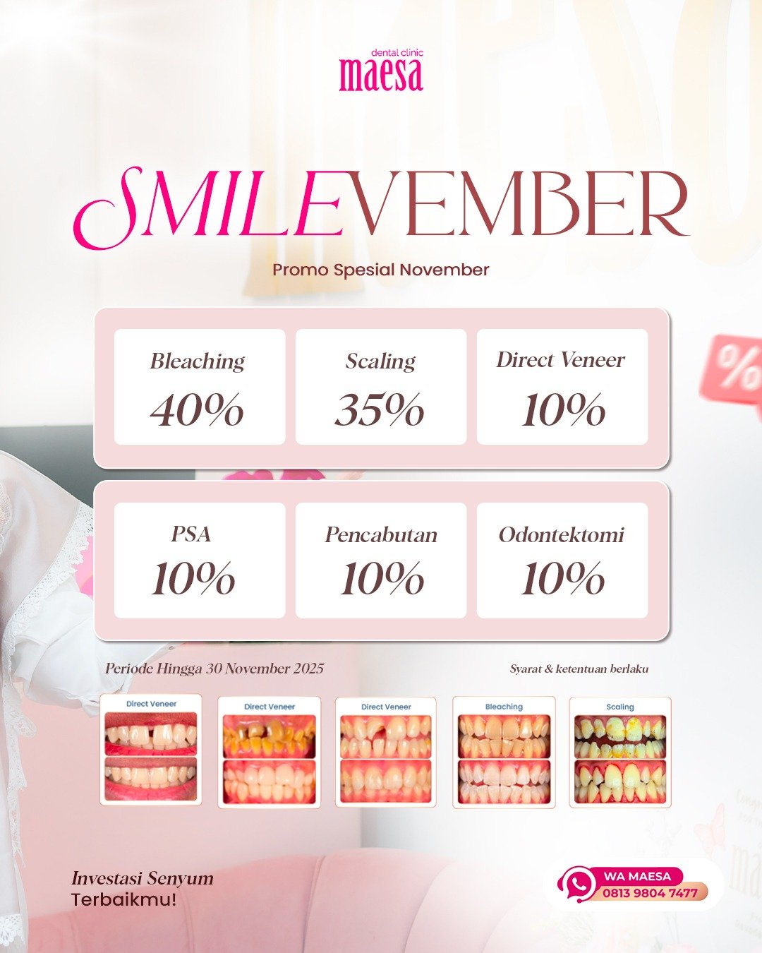 PROMO Maesa Dental Clinic | Klinik Gigi Terbaik - Smilevember