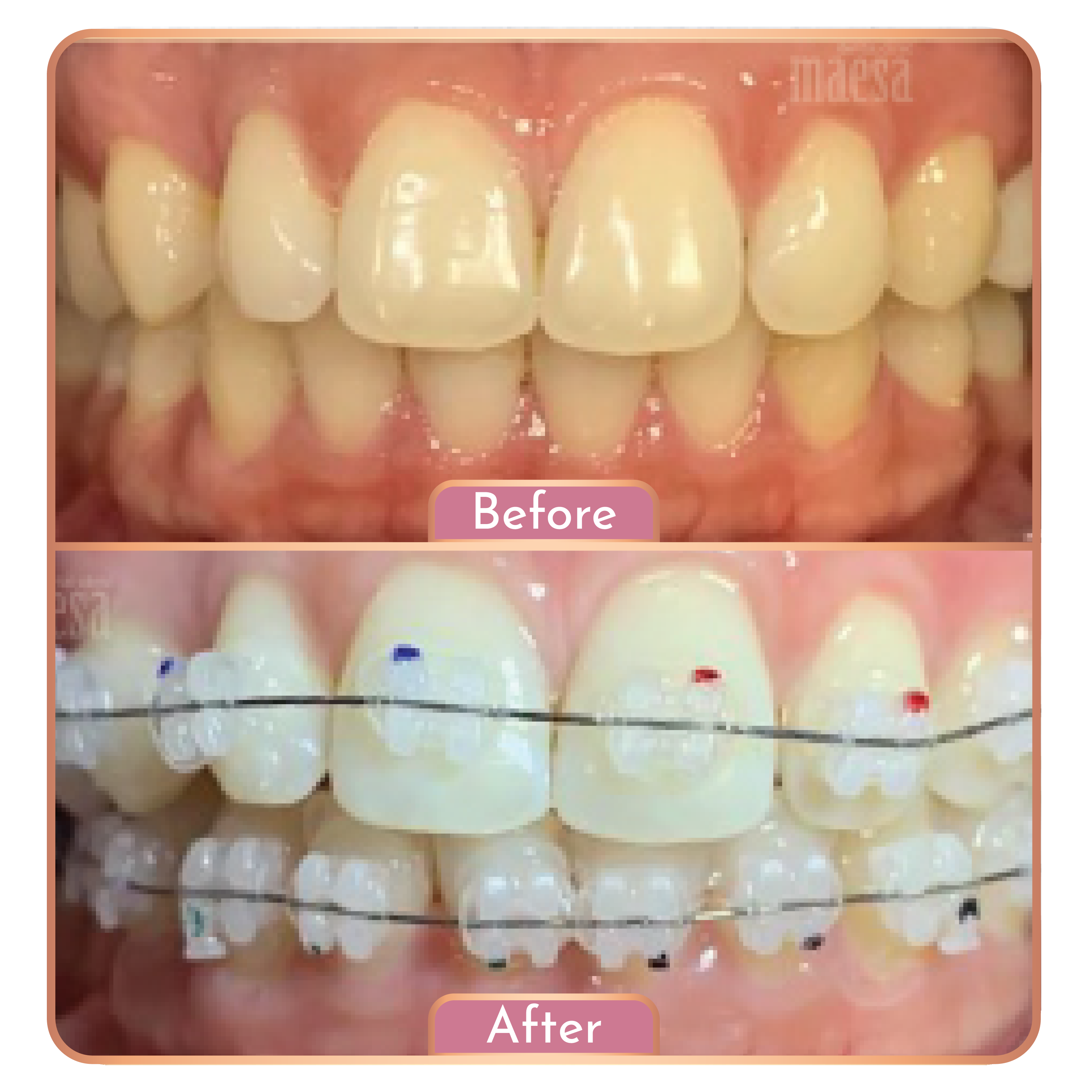 Maesa Dental Clinic
