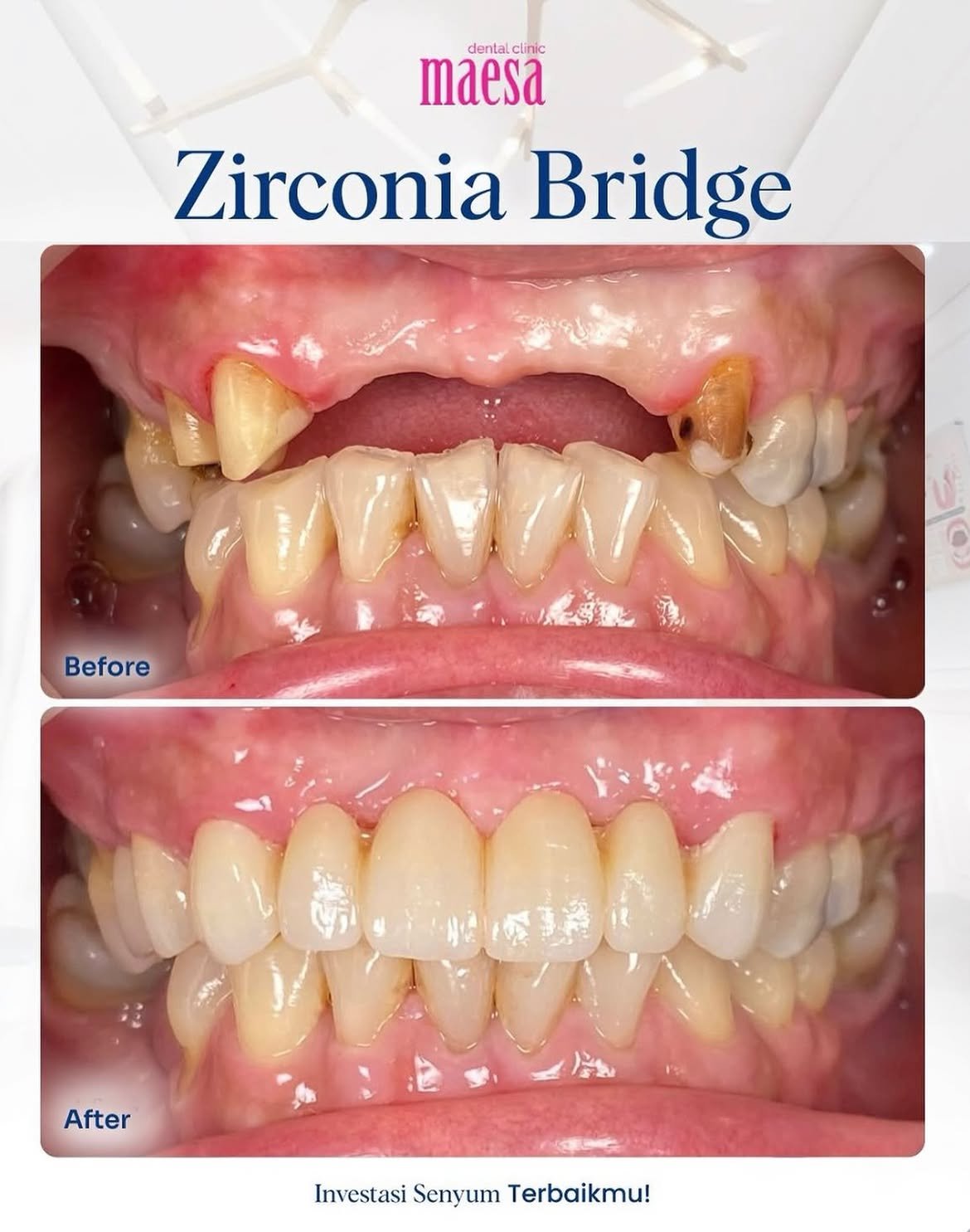 Instagram Maesa Dental Clinic | Klinik Gigi Terbaik