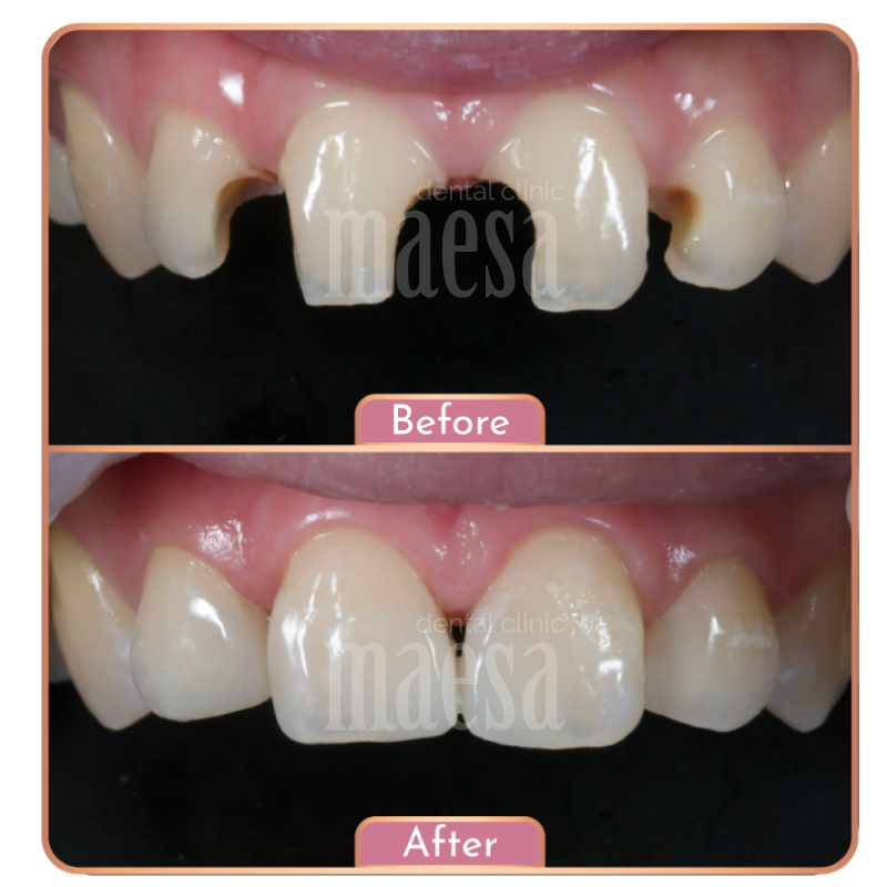 Maesa Dental Clinic