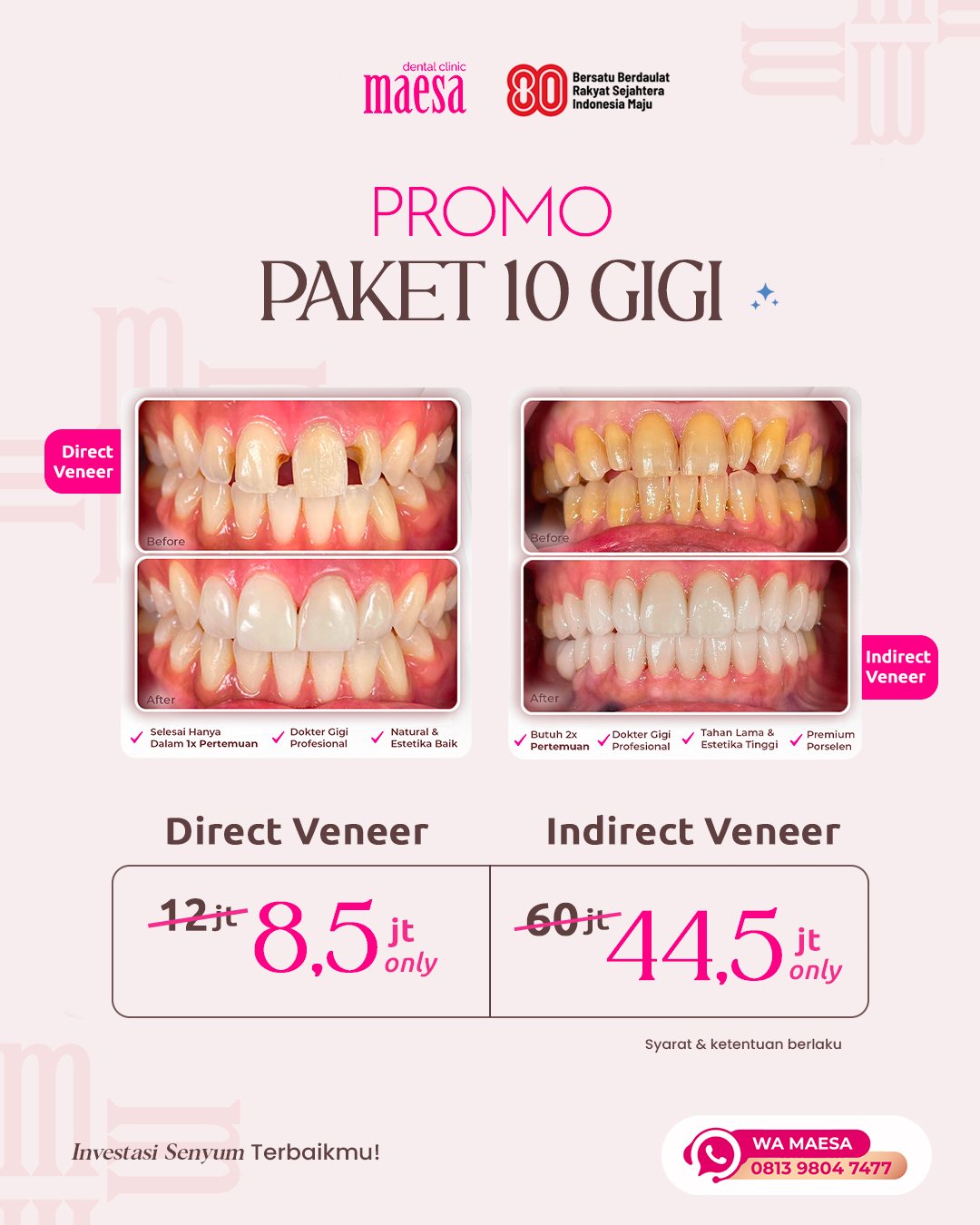 Instagram Maesa Dental Clinic | Klinik Gigi Terbaik