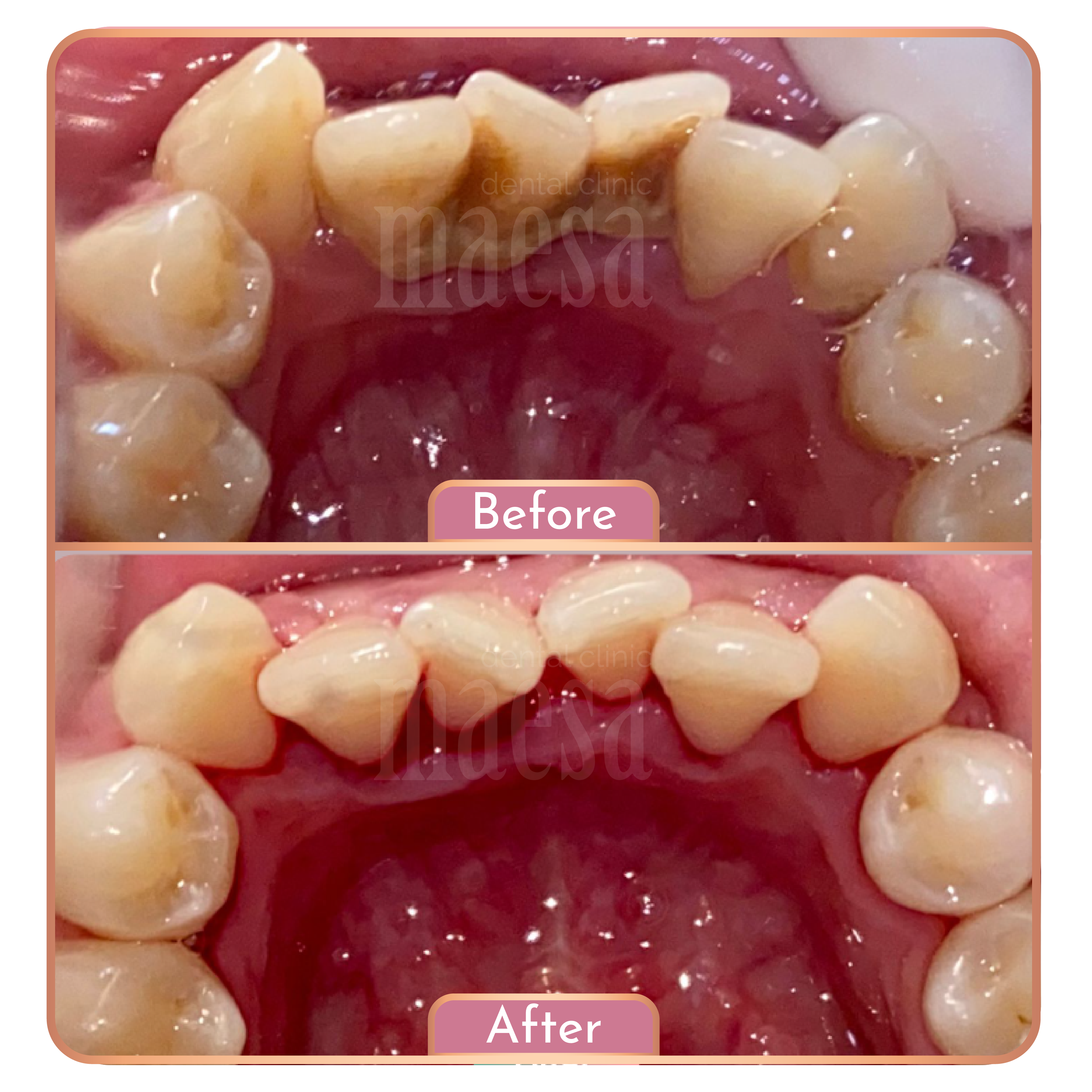 Maesa Dental Clinic