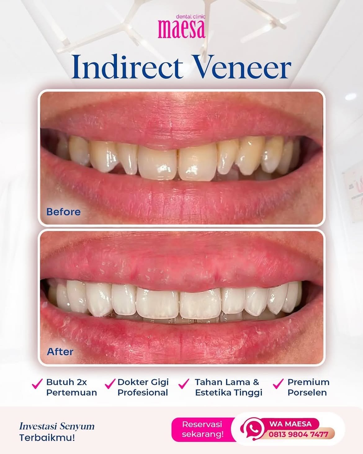 Instagram Maesa Dental Clinic | Klinik Gigi Terbaik