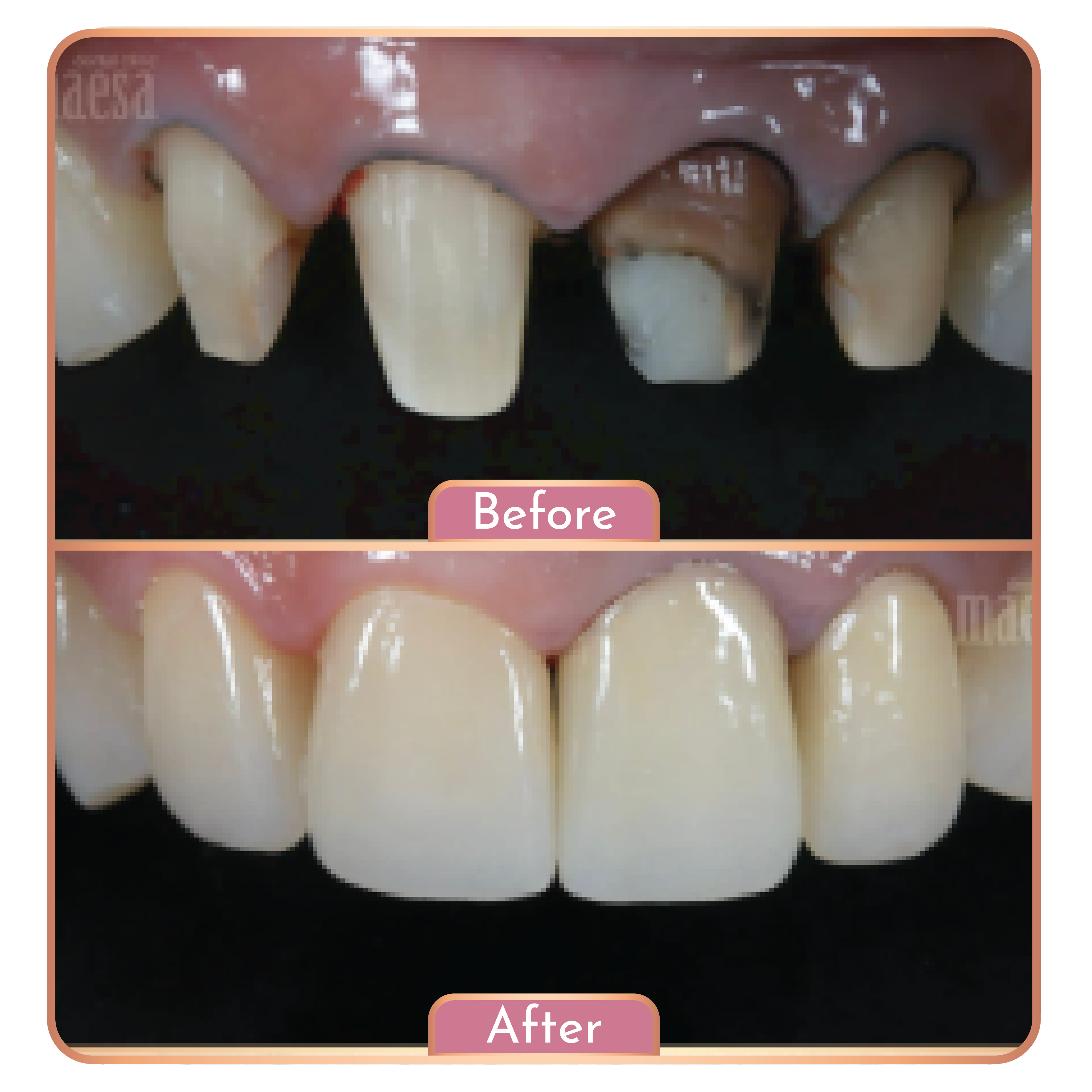 Maesa Dental Clinic