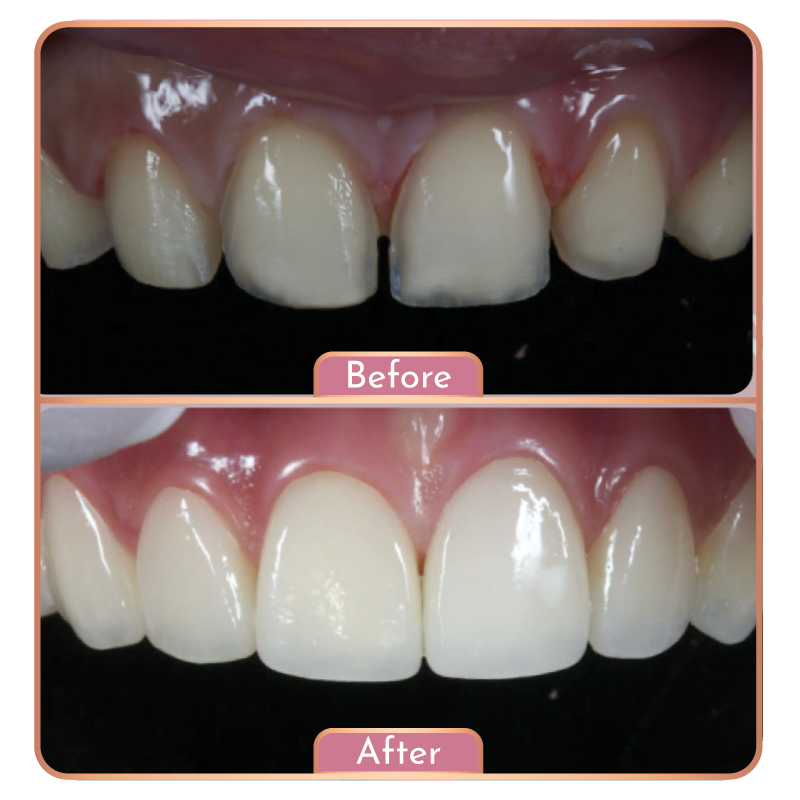 Maesa Dental Clinic