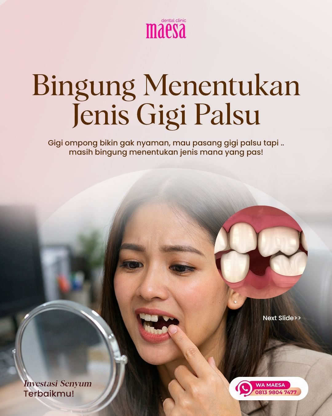 Instagram Maesa Dental Clinic | Klinik Gigi Terbaik